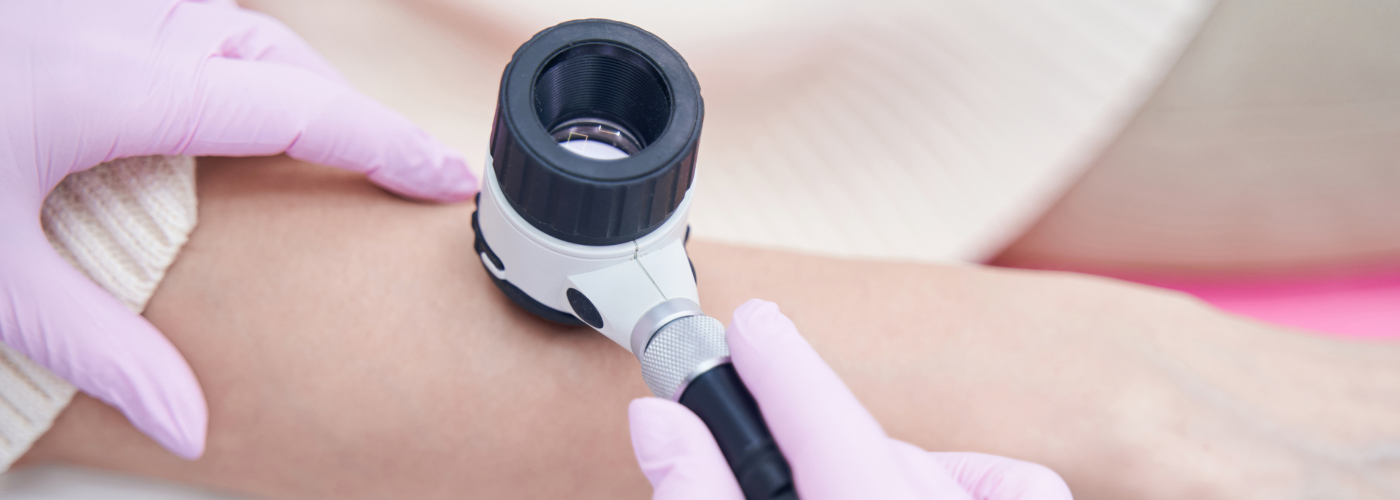 badanie znamion dermatoskopia